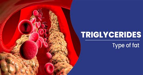 triglyceride test from drop of blood|why do you check triglycerides.